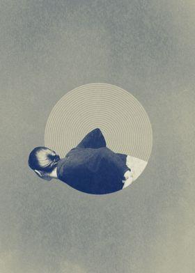 Çoklu Çember Sendromu