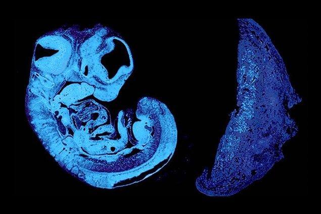 Yeni Bir Araştırma: Cinsiyetler Savaşı Anne Karnında Başlıyor