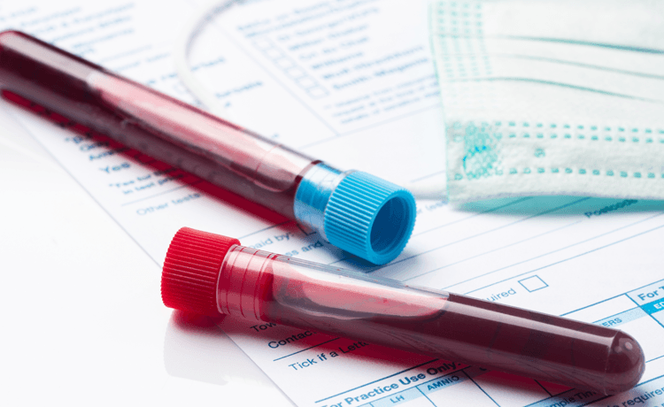 AIDS'e Karşı Geliştirilen Aşının İnsan Üzerindeki Denemelerine Başlandı