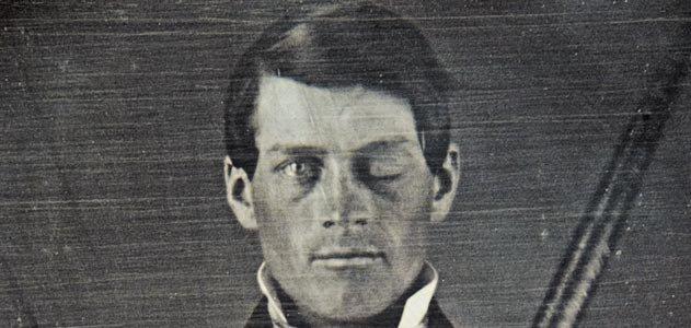 Sinirbilimde Devrim Yaratan Hasta: Phineas Gage