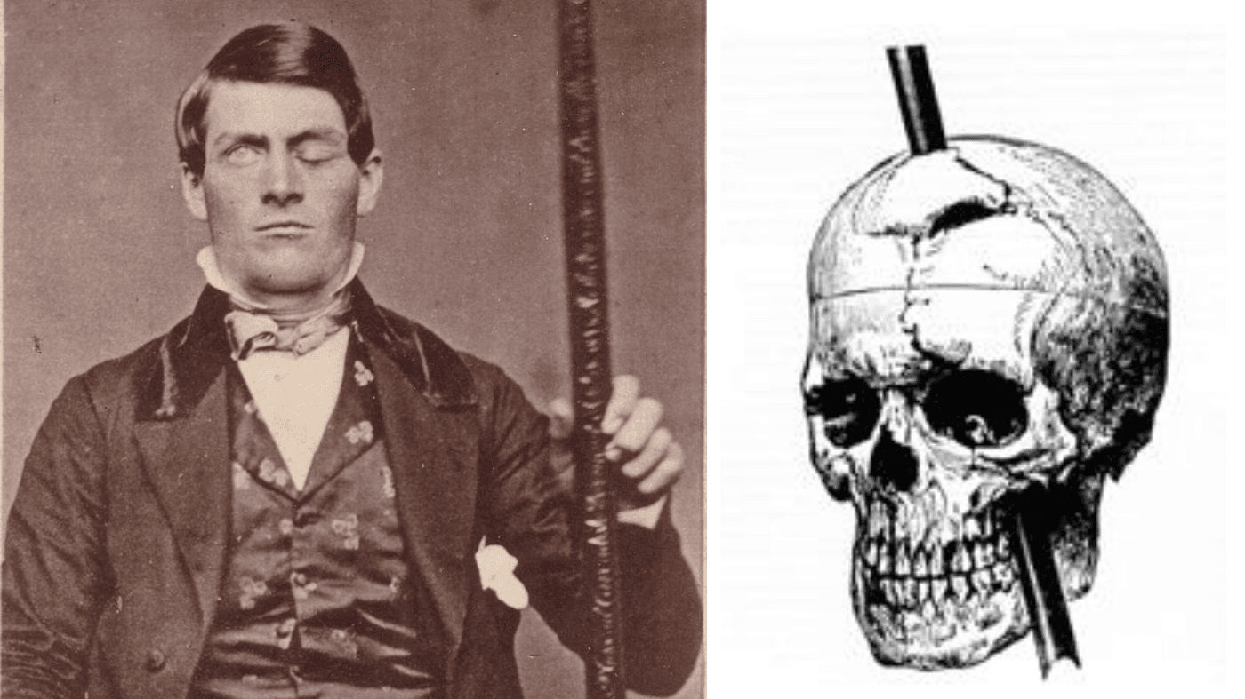 Korkunç Kaza: Phineas Gage Vakası