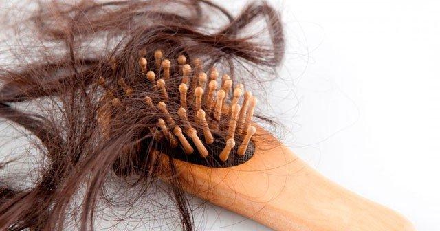 Saç Dökülmesi ve Seboreik Dermatit