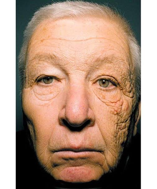 Yazın Olmazsa Olmazlarından: Güneş Kremi