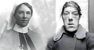 En çirkin kadın: Marry Ann Bevan