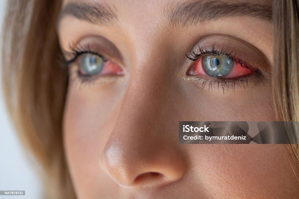 Kan damlaları - Ama