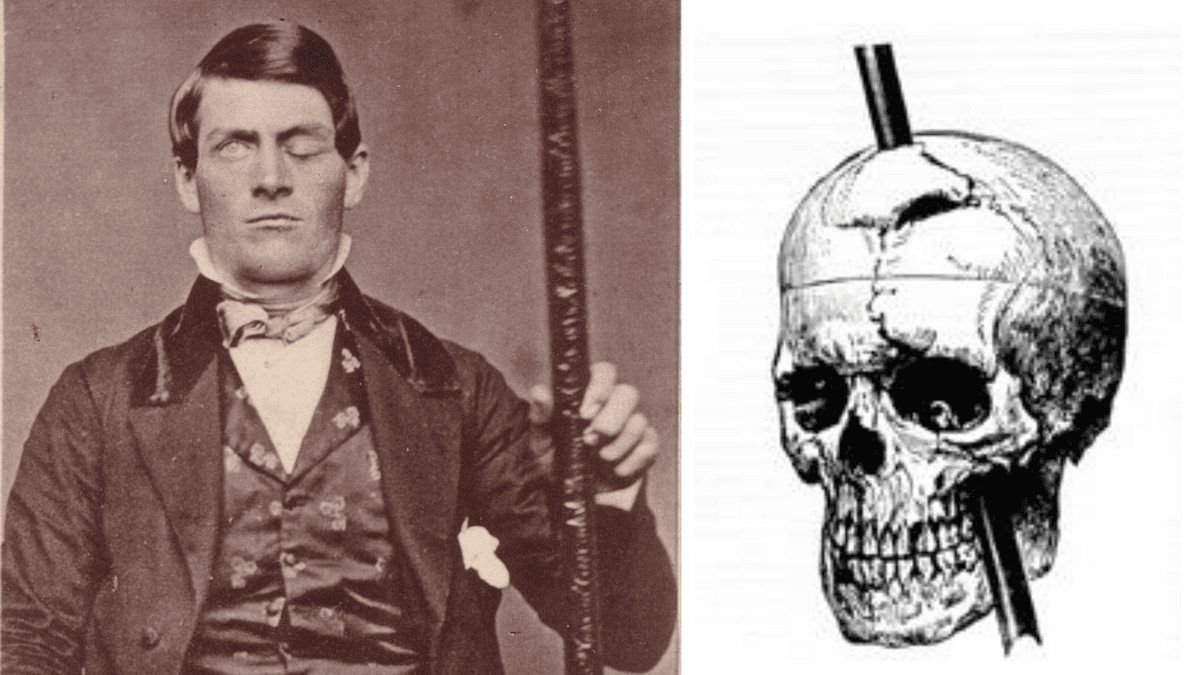 Korkunç Kaza: Phineas Gage Vakası