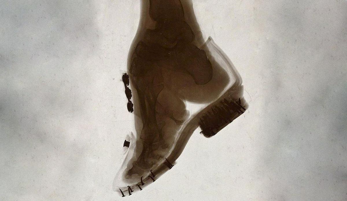 Ölümcül Güzellik II: Ayak Bağı Olarak Moda