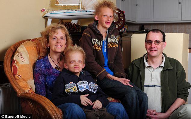 Vampir Hastalığı: Porfiria