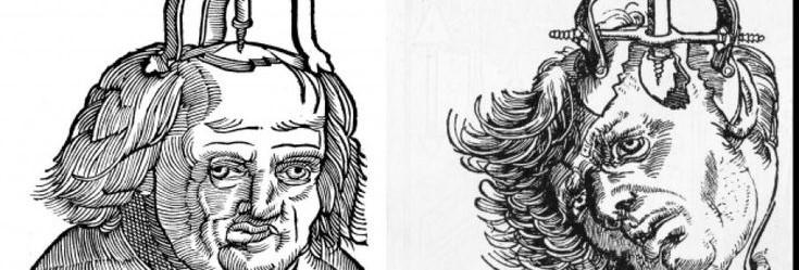 Dark History  of Lobotomy