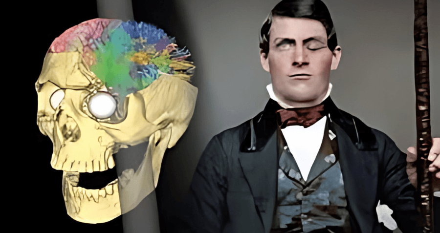 Phineas Gage: Beyin Hasarının Kişilik Üzerine Etkisi