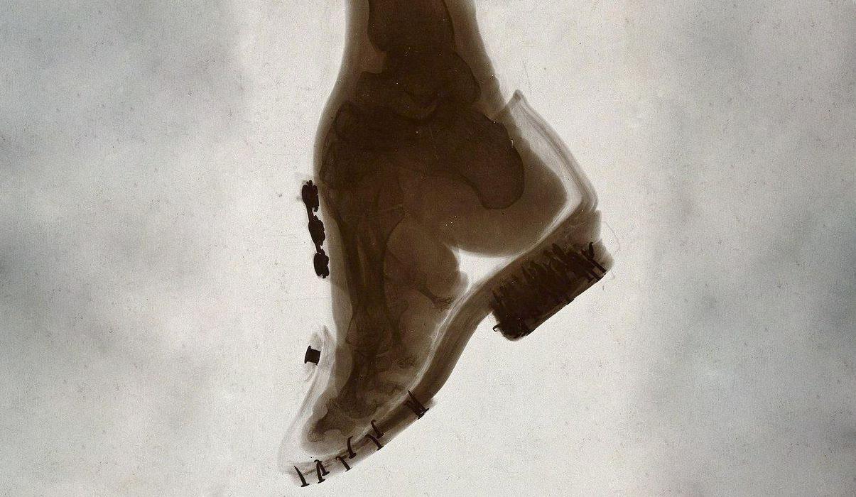 Ölümcül Güzellik II: Ayak Bağı Olarak Moda