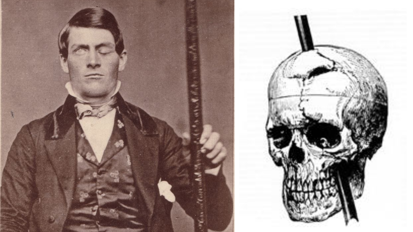 Phineas gage cigar