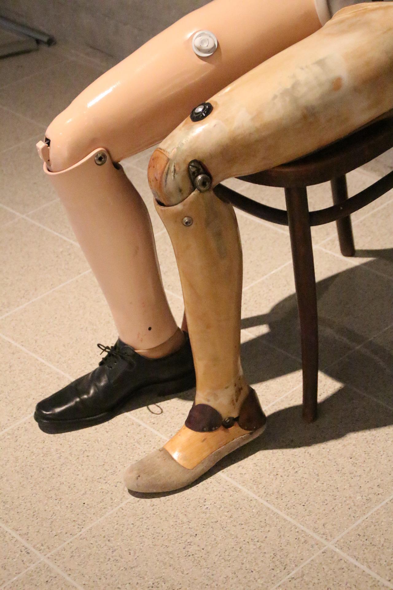 how nasa was used for prosthetic limbs